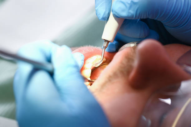 Best Pediatric Emergency Dentist in Ashland City, TN
