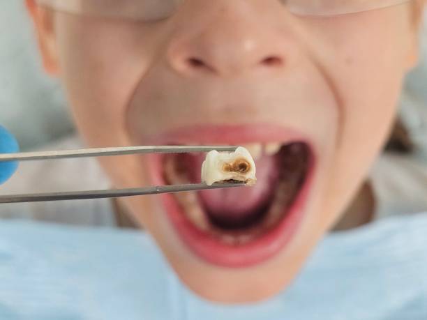 Best Emergency Dental Services for Seniors in Ashland City, TN
